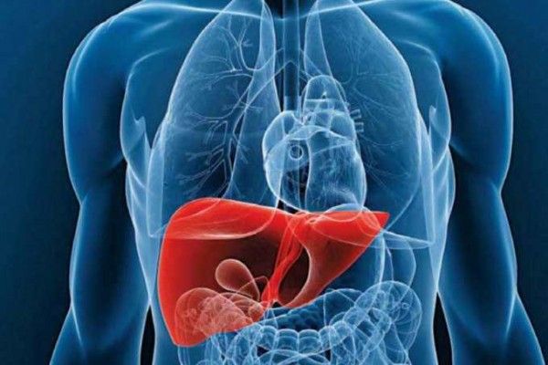 Hígado graso o esteatosis hepática ¿Qué es realmente?