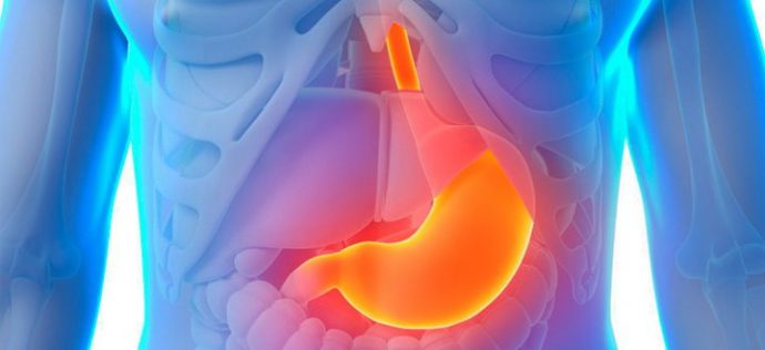 Qué es la gastritis, las causas y sus síntomas